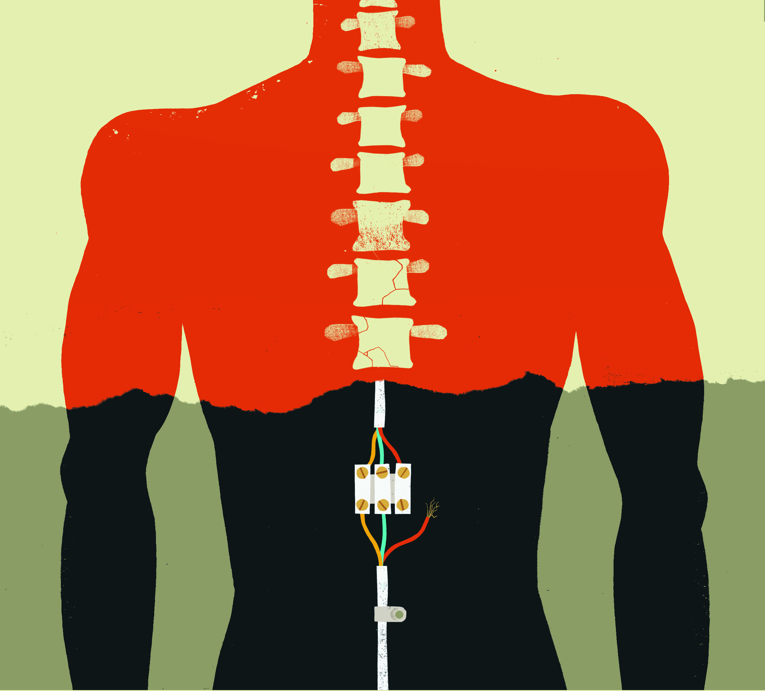 Spinal injury