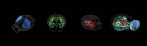 Primer mapa de cada neurona en el cerebro