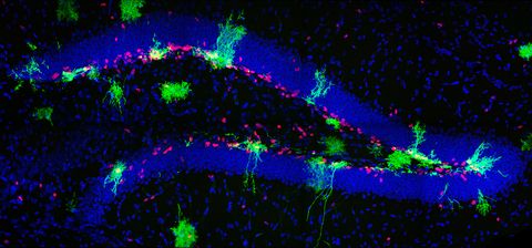 ¿Dónde y cómo nacen las neuronas? Ya tenemos la respuesta