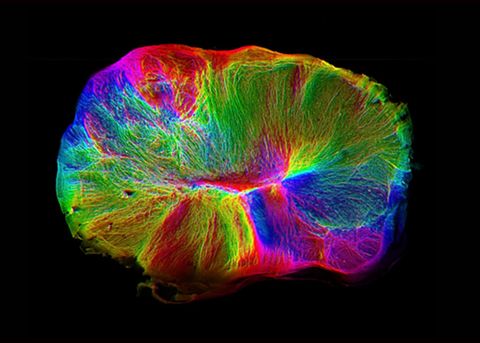Este mini cerebro cultivado en laboratorio se conecta sin ayuda… ¡a una espina dorsal!