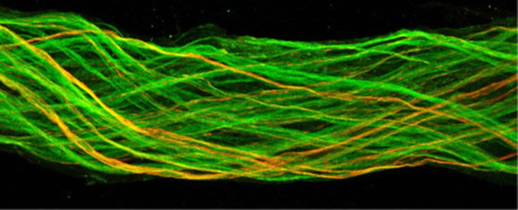 Anular estas neuronas produce obesidad 1 anular estas neuronas produce obesidad Anular estas neuronas produce obesidad