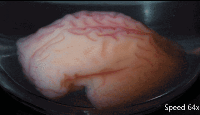 Así es un cerebro humano impreso en 3D