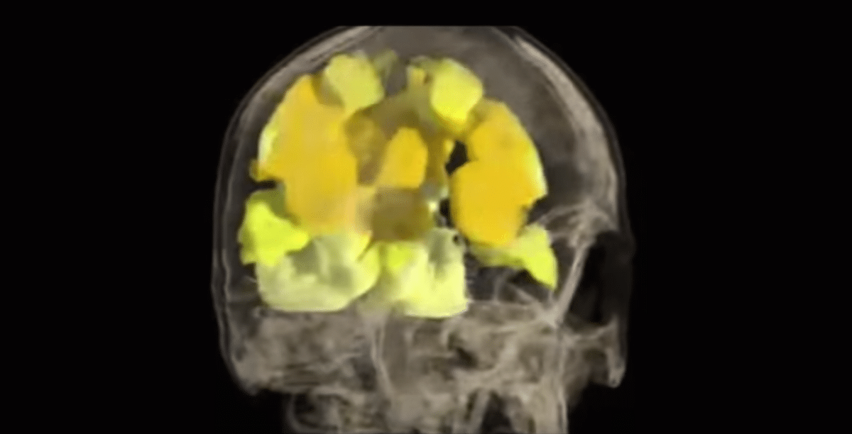 Así se ve un orgasmo en el cerebro