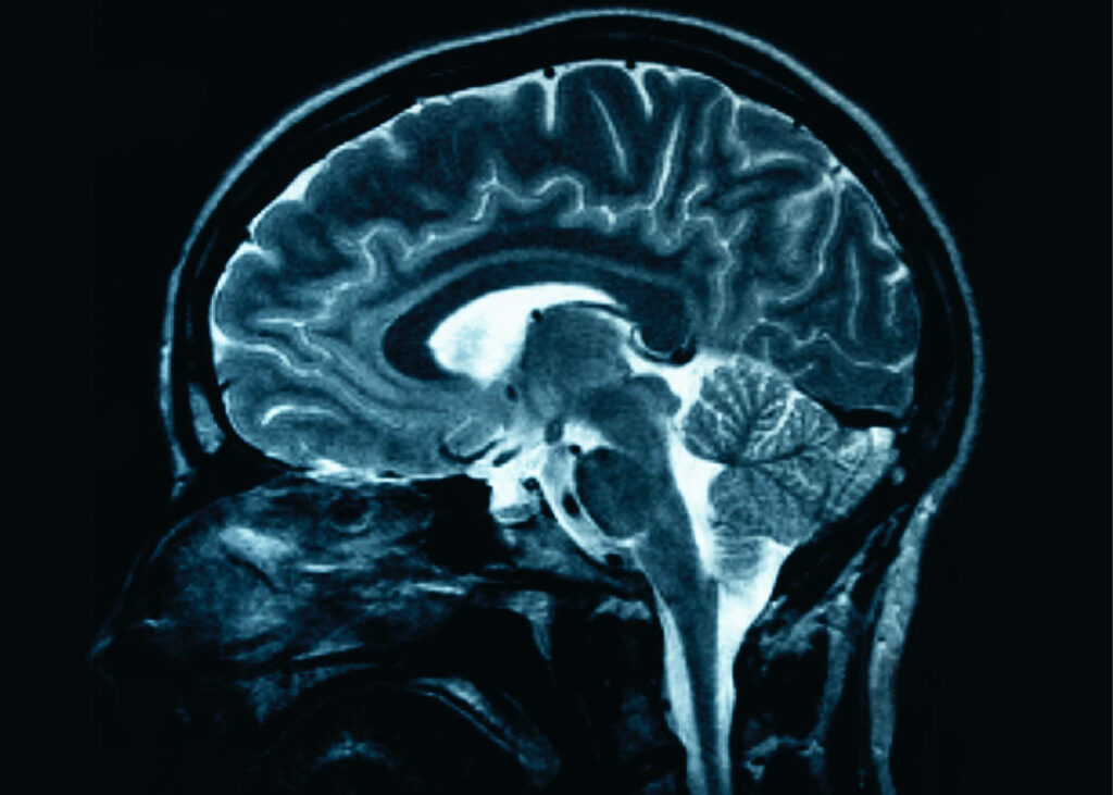 En coma, pero aprende 1 cerebro en coma En coma, pero aprende