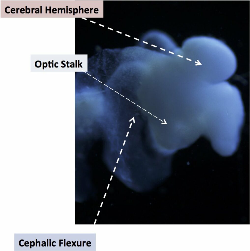 Científicos consiguen crear un cerebro humano casi perfecto 1 cientificos consiguen crear un cerebro humano casi perfecto Científicos consiguen crear un cerebro humano casi perfecto