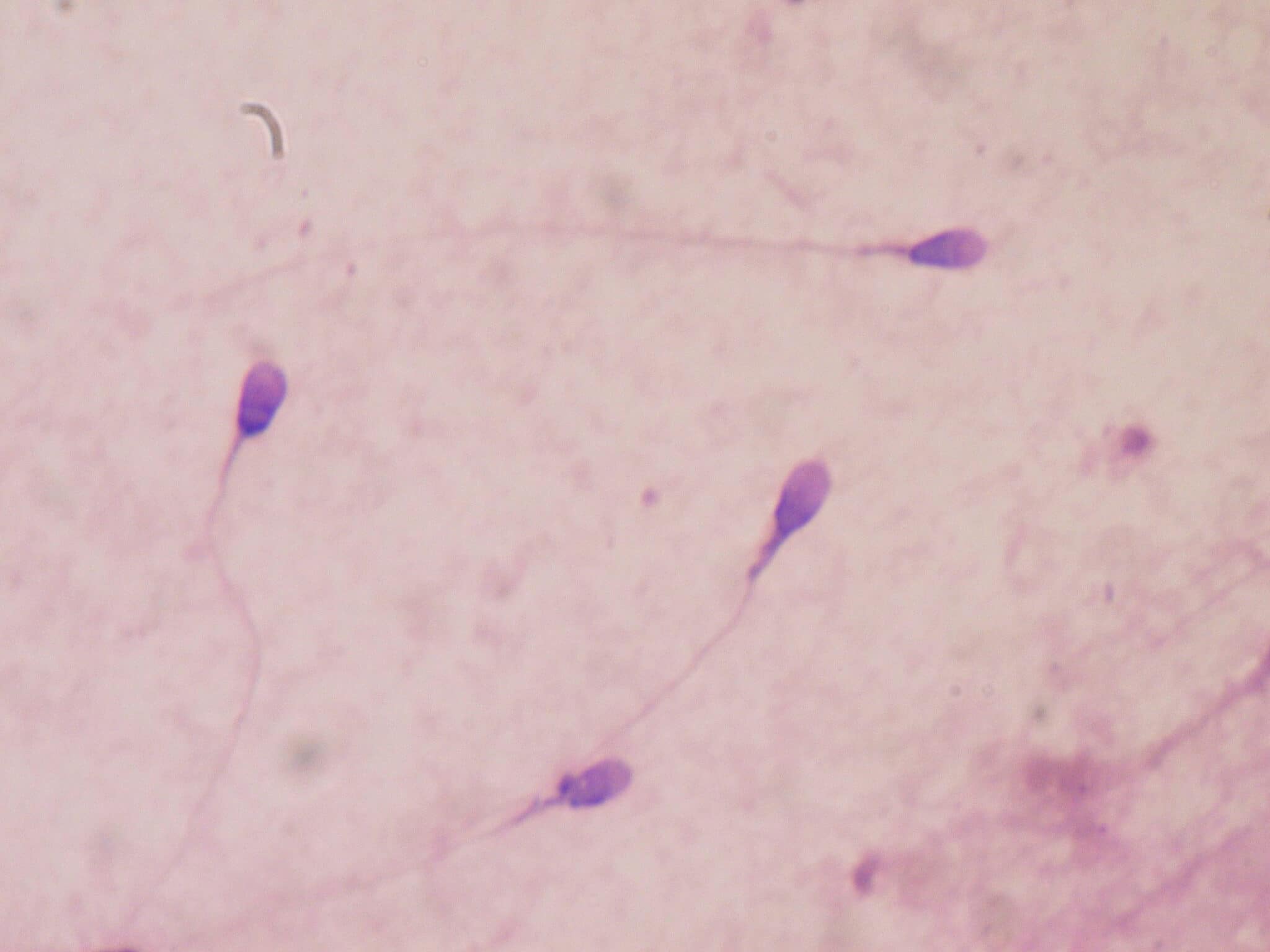Científicos españoles crean esperma a partir de células dérmicas