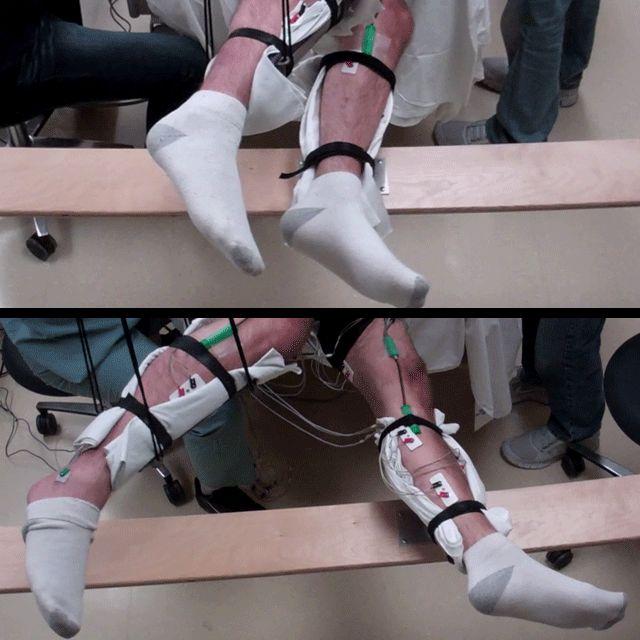 Cinco personas con parálisis vuelven a mover voluntariamente sus piernas