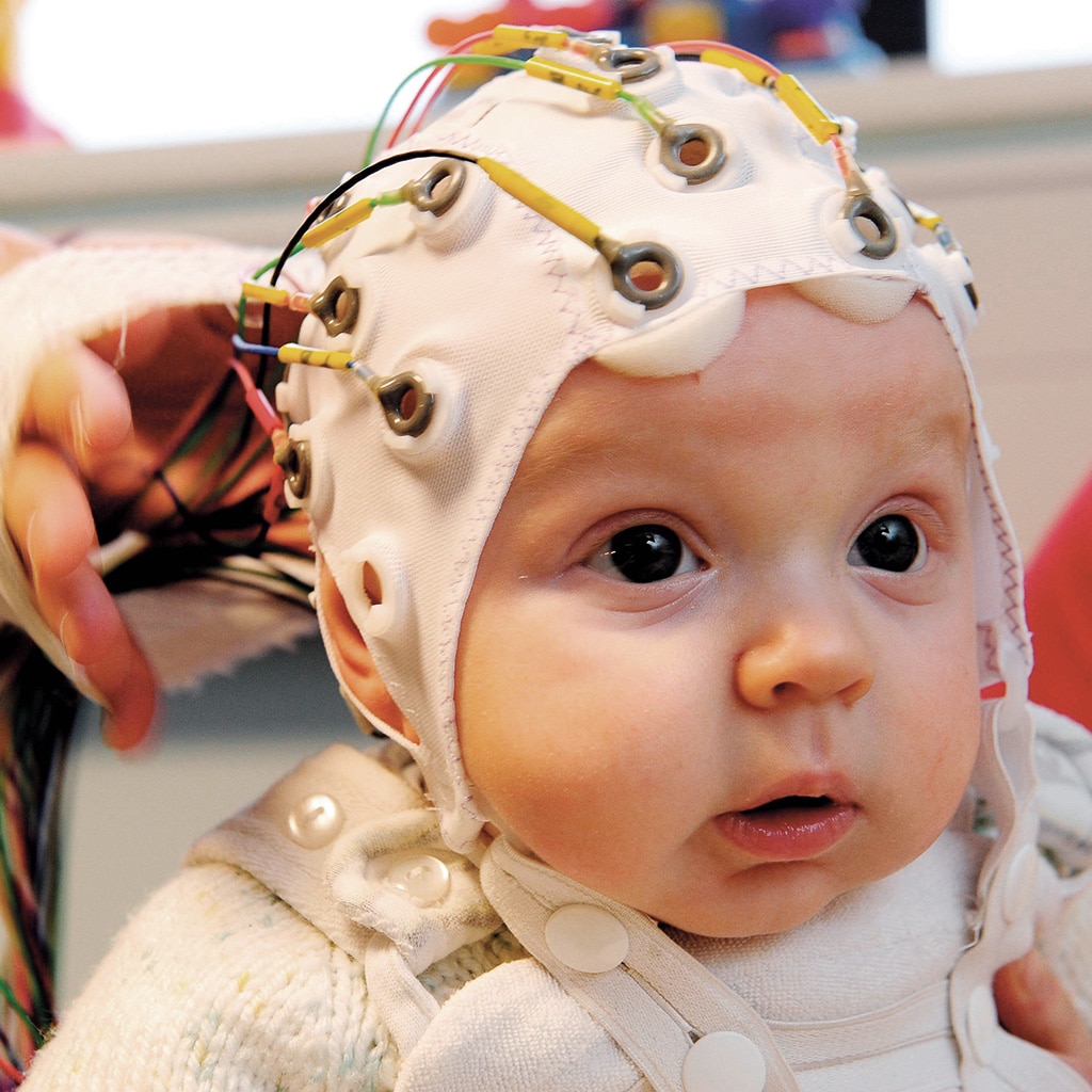 ¿Cómo estudian los expertos el cerebro de los bebés?