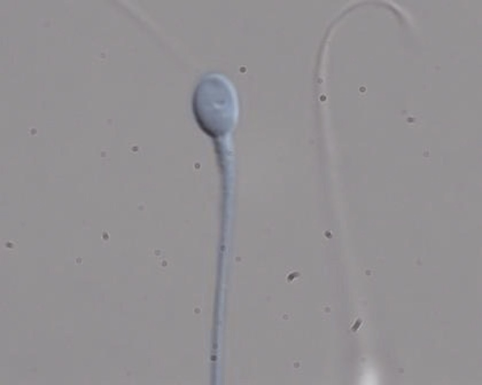 Cómo cazan los óvulos espermatozoides