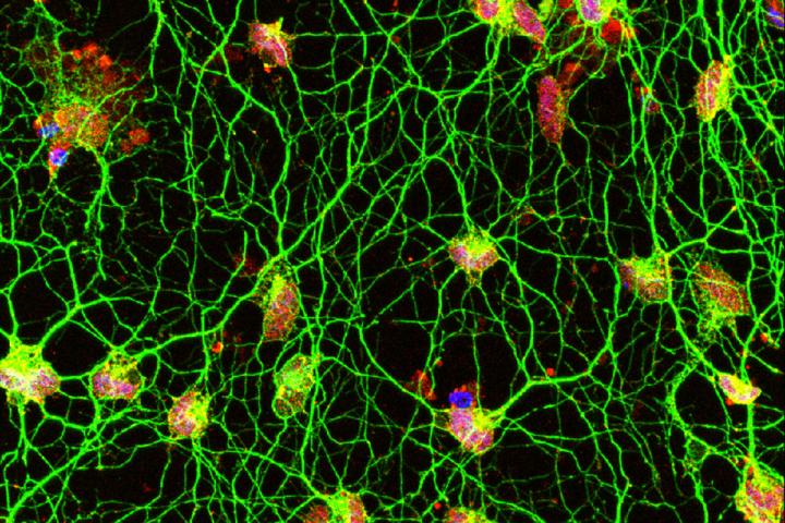 Convierten células dérmicas en neuronas