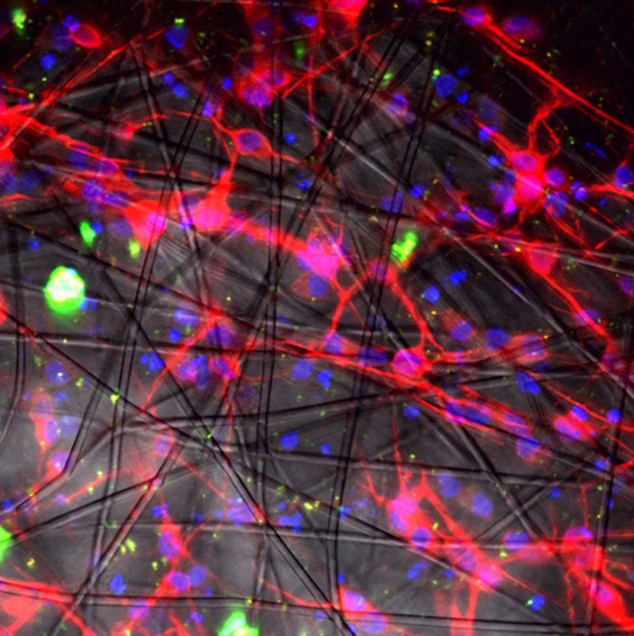 Crean un molde para trasplante de neuronas obtenidas de células madre