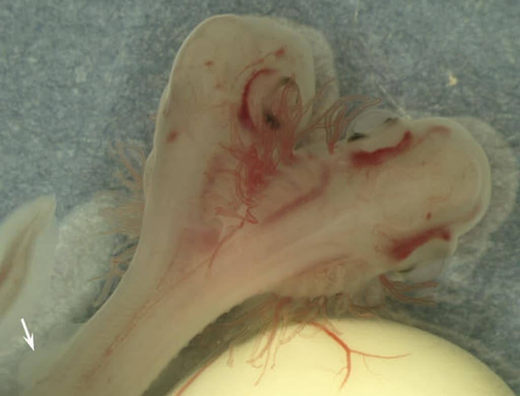 Descubren el embrión de un tiburón con dos cabezas