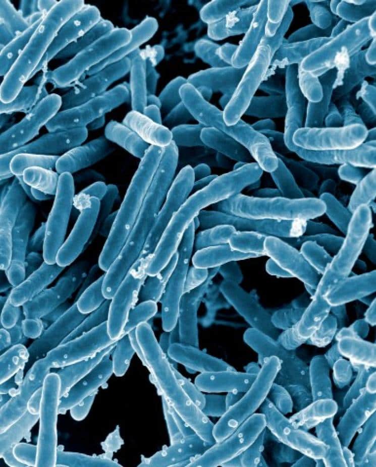 Diagnosticar la tuberculosis con un papel