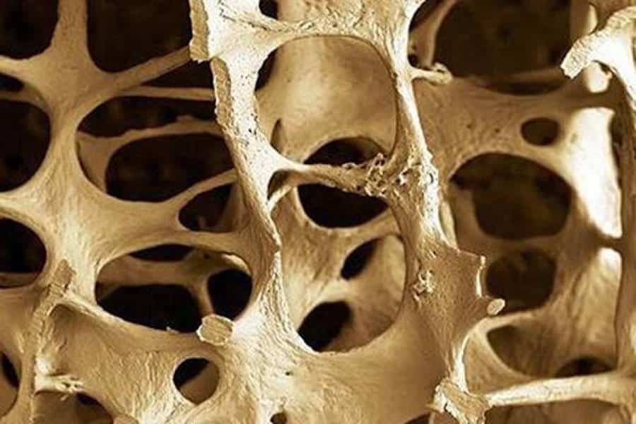 El estudio polémico de la semana: hierbas chinas contra la osteoporosis