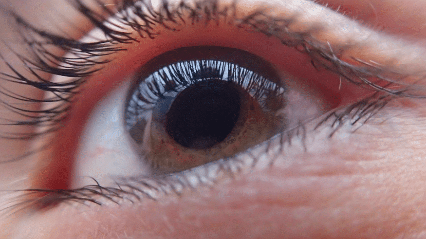 El glaucoma, ¿una enfermedad inmune?