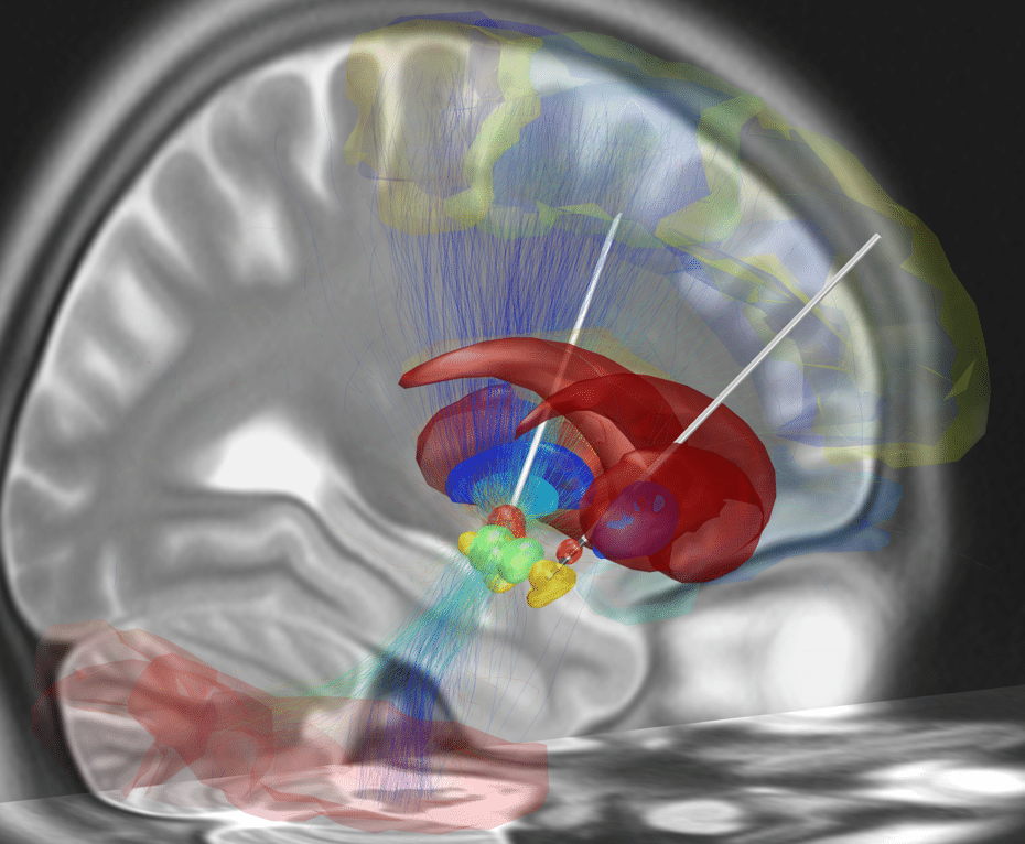 El mecanismo cerebral que detiene tu cuerpo, también paraliza tu mente