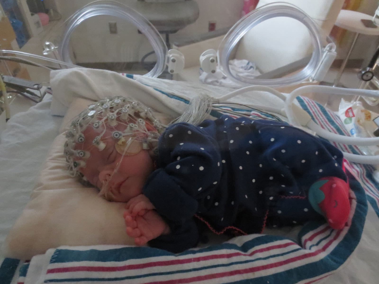 El tacto configura el cerebro de los bebes prematuros
