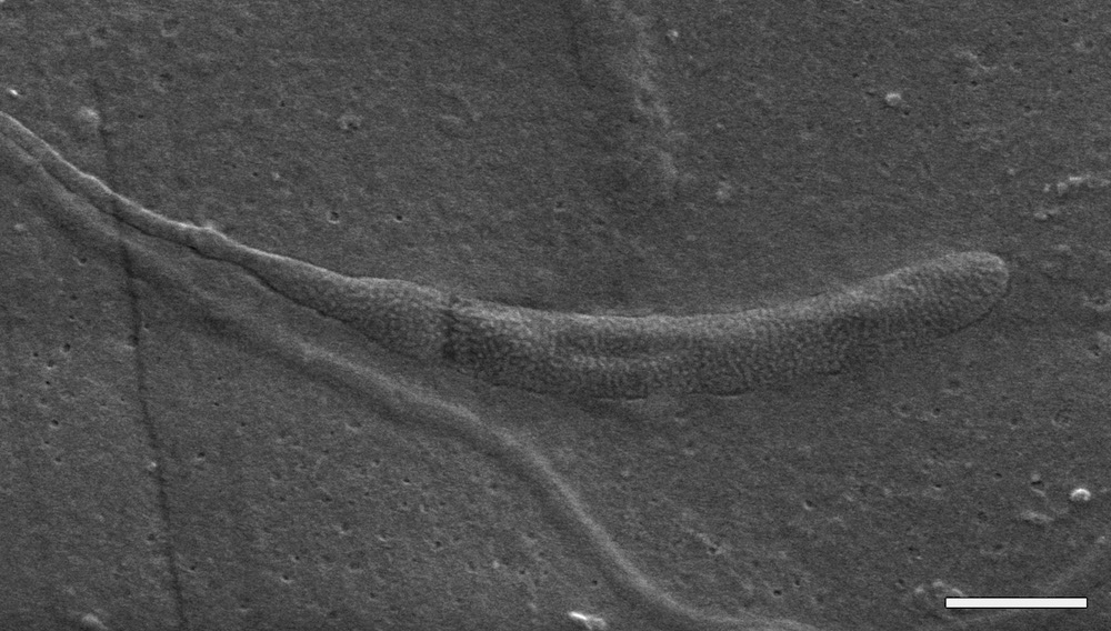 Encuentran el esperma más antiguo del mundo