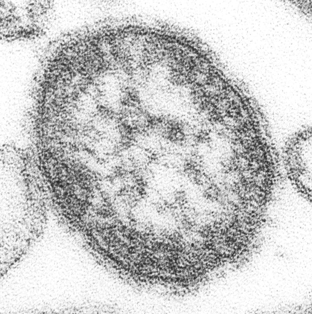 Epidemia de sarampión en Italia, ¿llegará a España?