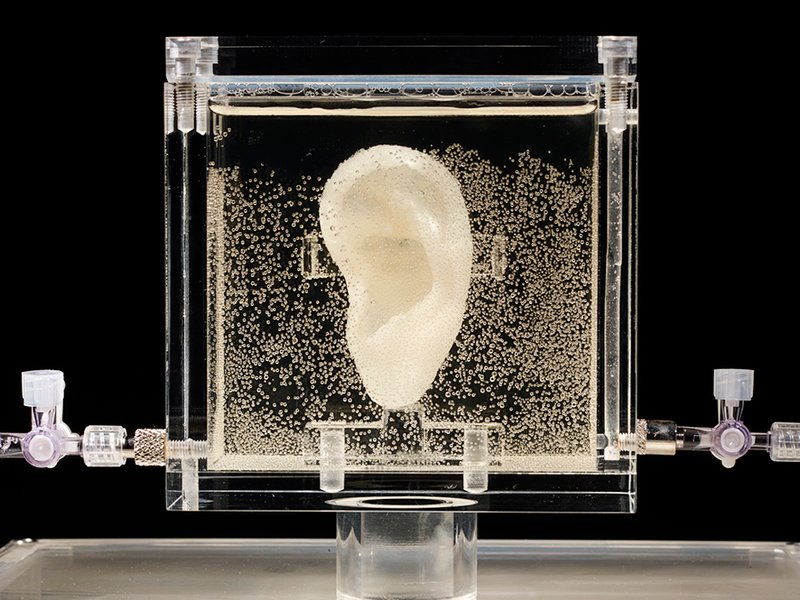Esta oreja contiene ADN de Van Gogh