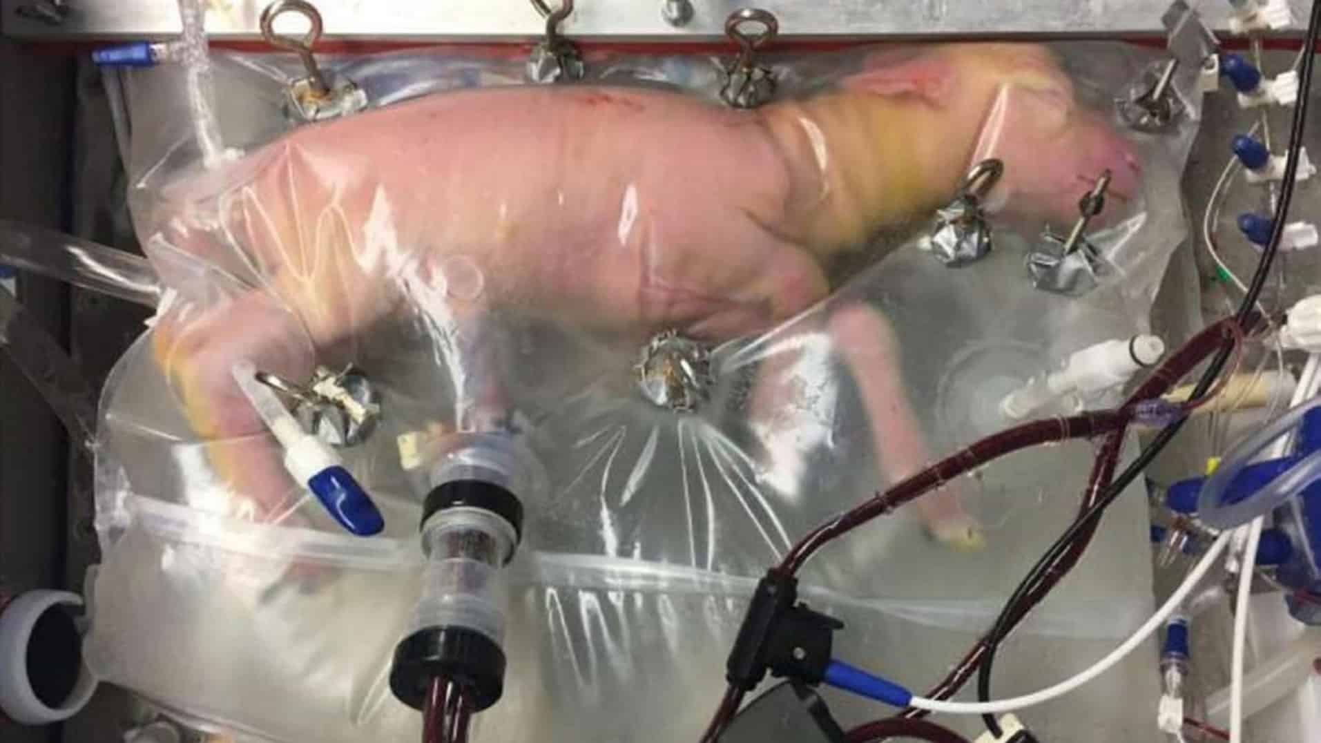 Este vientre artificial salvará la vida a miles de bebés