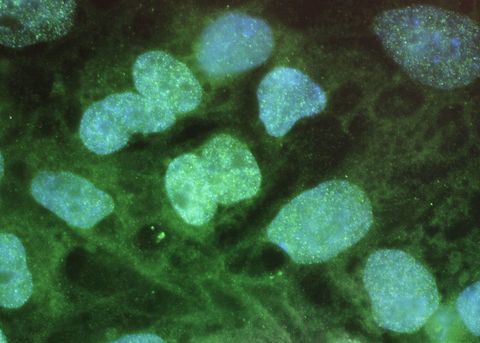 Científicos logran convertir células dérmicas en células madre embrionarias