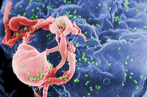 Por primera vez logran eliminar el VIH de un animal vivo