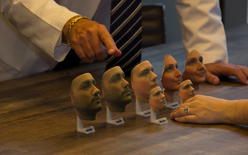 Imprime tu rostro en 3D antes de la cirugía estética