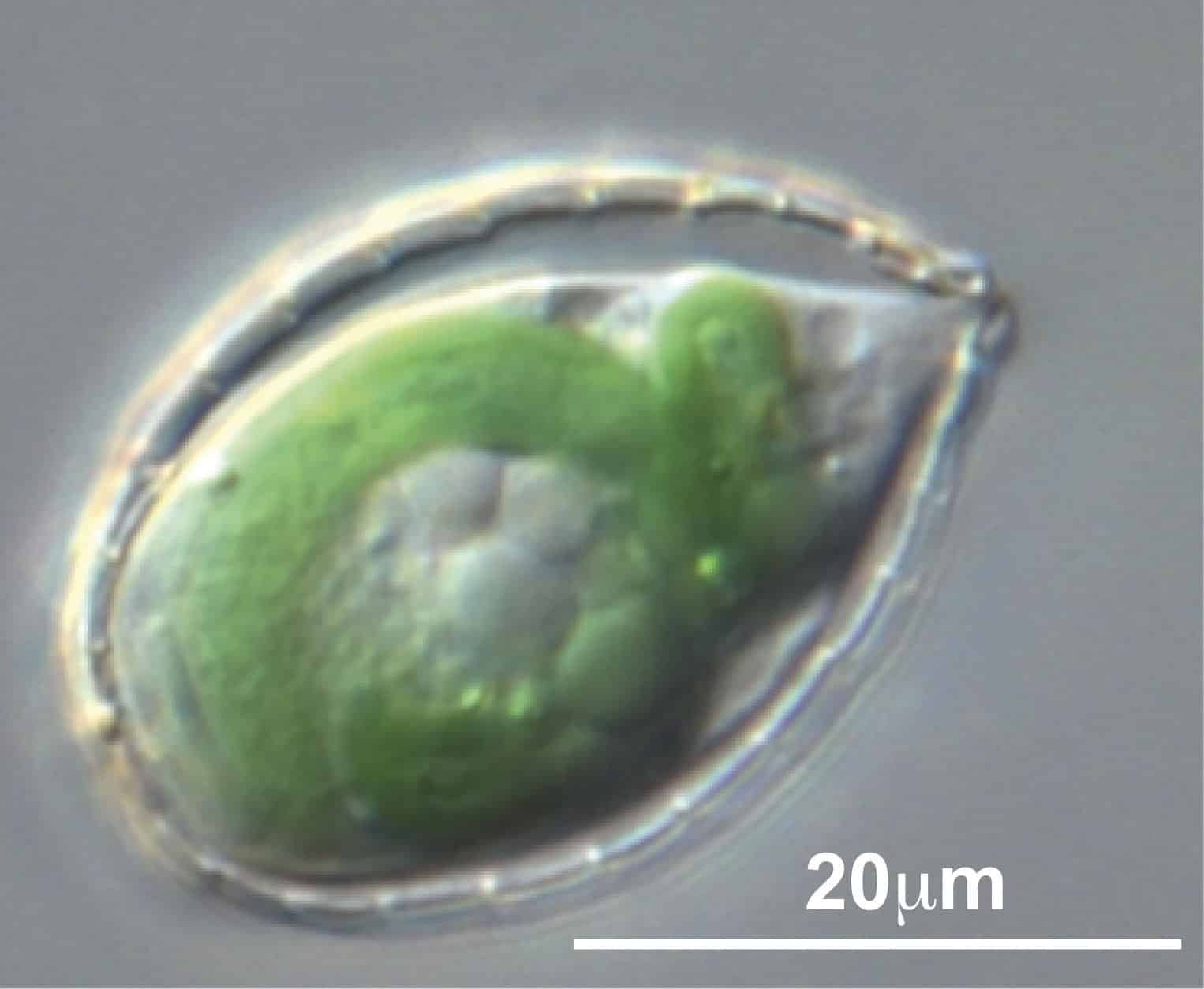 La ameba que se tragó una bacteria para ser fotosintética
