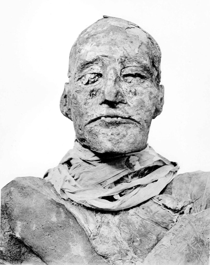 La momia de Ramses III fue sometida a cirugía estética