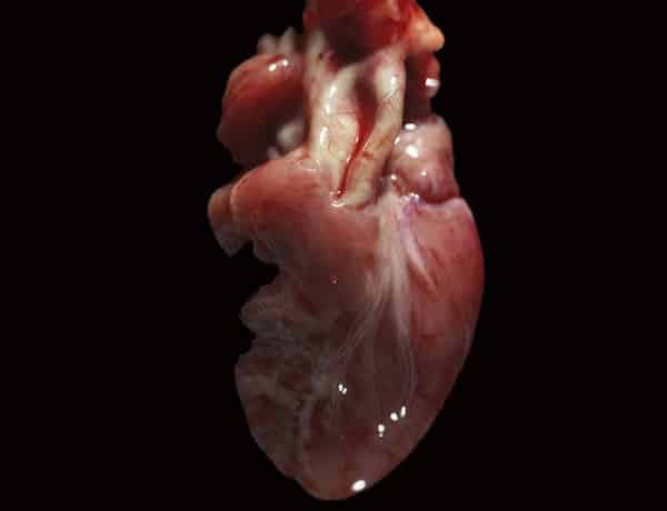La primera hora de vida de un bebé: Sistema circulatorio