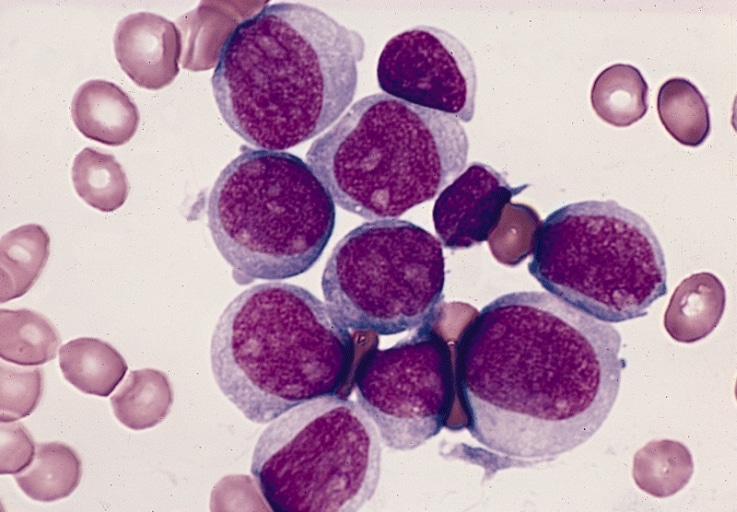 Las células cancerosas frenan al sistema inmune