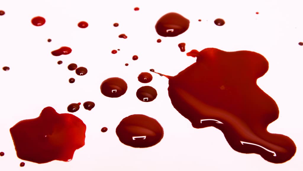 Las personas con el tipo de sangre 0 podrían tener más riesgo de morir por una herida grave
