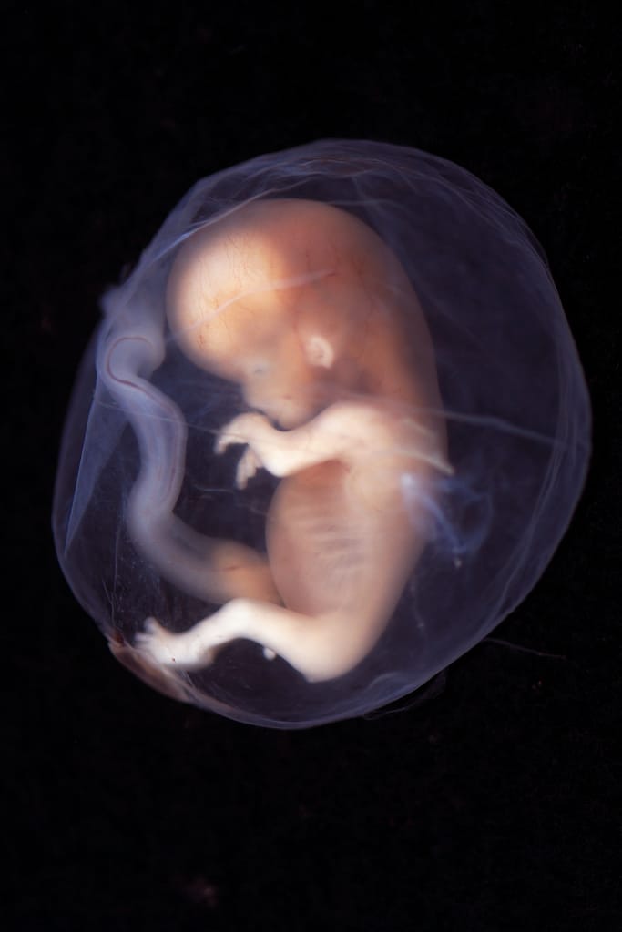 Lo que el fluido uterino le cuenta al feto sobre su madre
