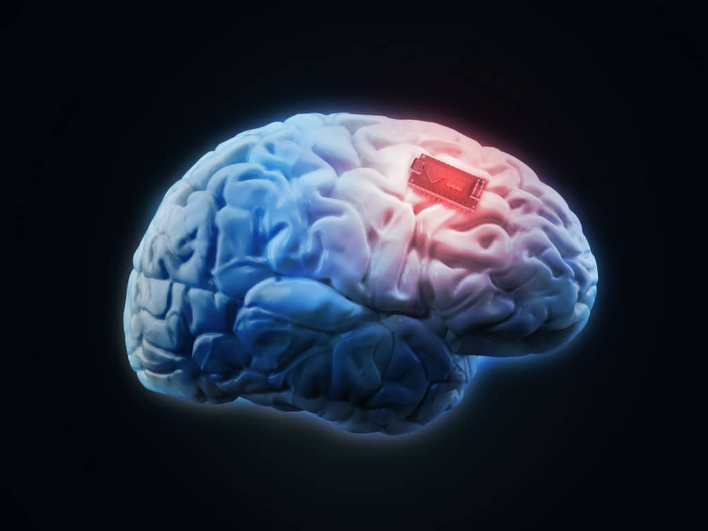 Logran potenciar la memoria con un implante cerebral