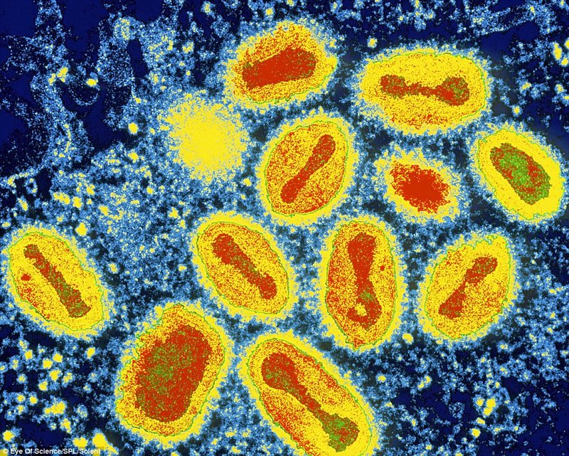 Los 10 virus más mortales de la historia