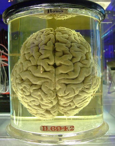 Los cerebros más inteligentes consumen más sangre