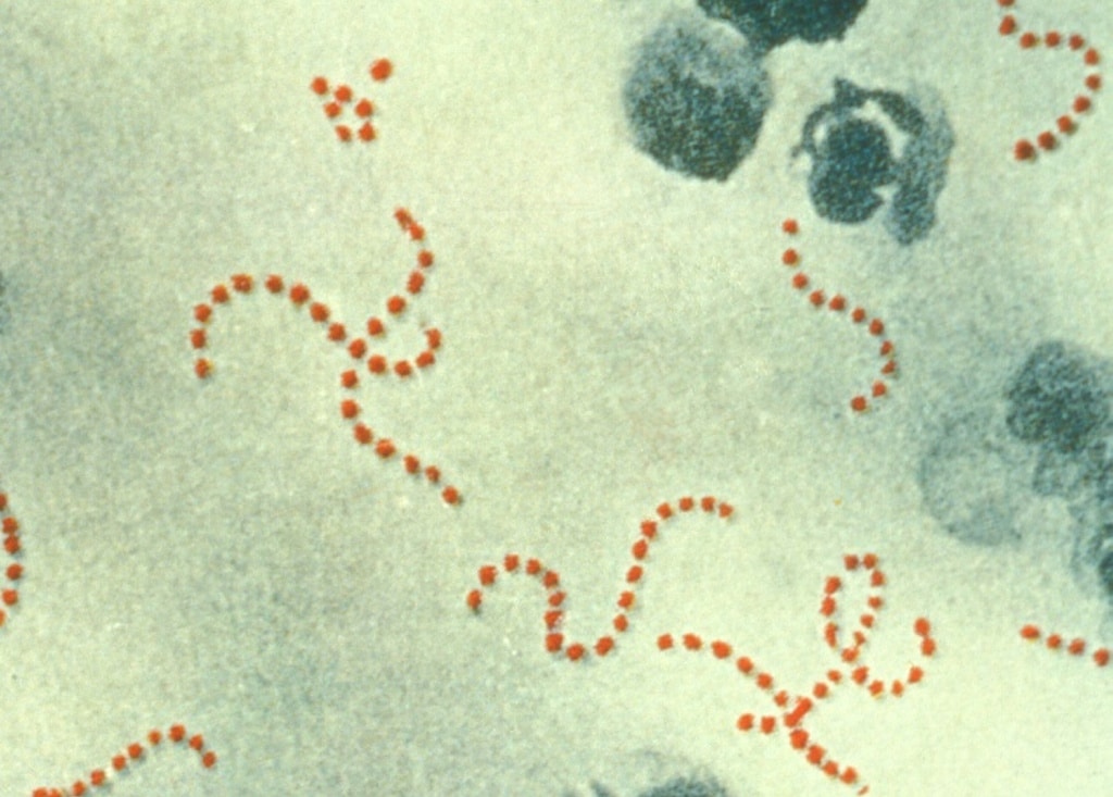 Los síntomas de la bacteria come carne pueden confundirse con los de la gripe