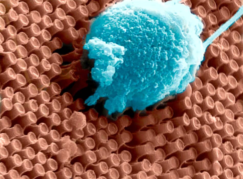 Nanoimplantes para devolver la vista