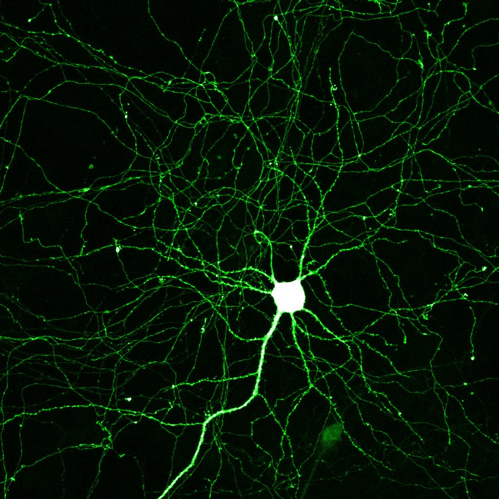 ¿Neuronas nuevas?