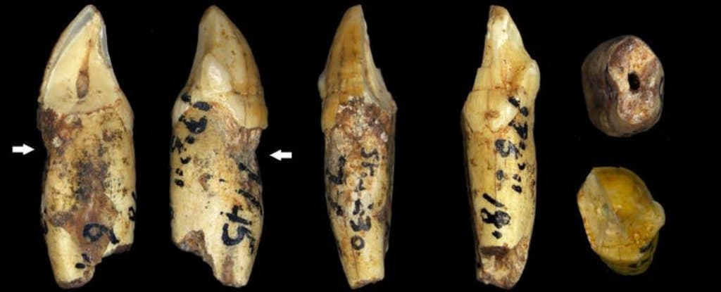 Nuestros ancestros ya tenían los mismos problemas dentales que nosotros