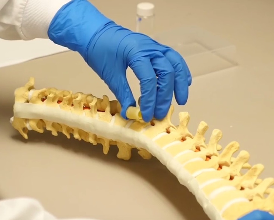 Nuevo material para reparar lesiones vertebrales