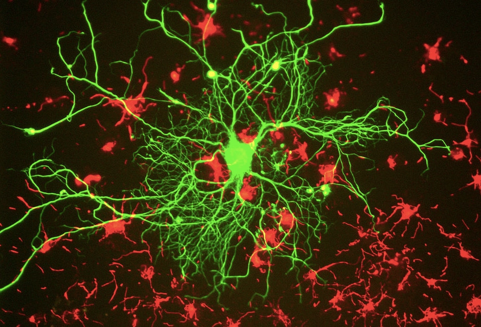¿Para qué sirven estas neuronas… en tu oído?