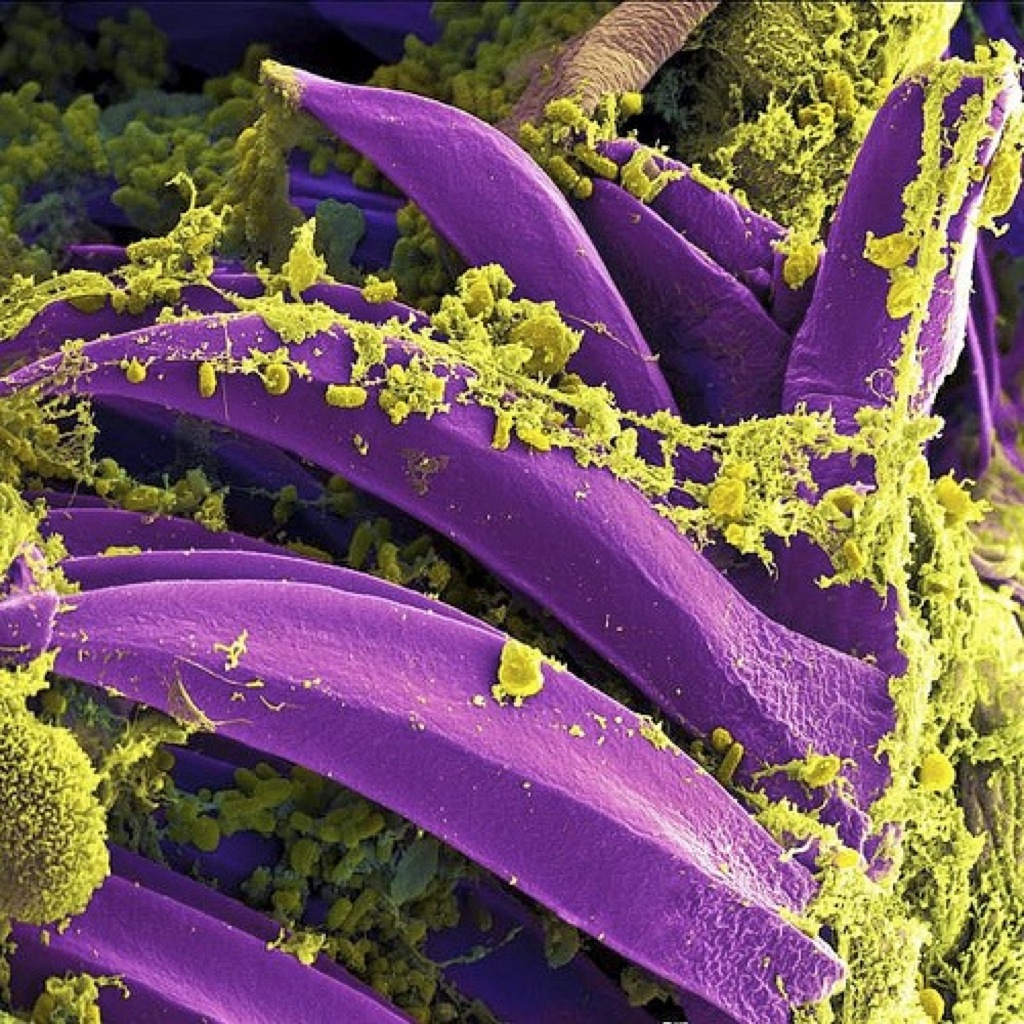 ¿Podría haber una nueva epidemia de peste?
