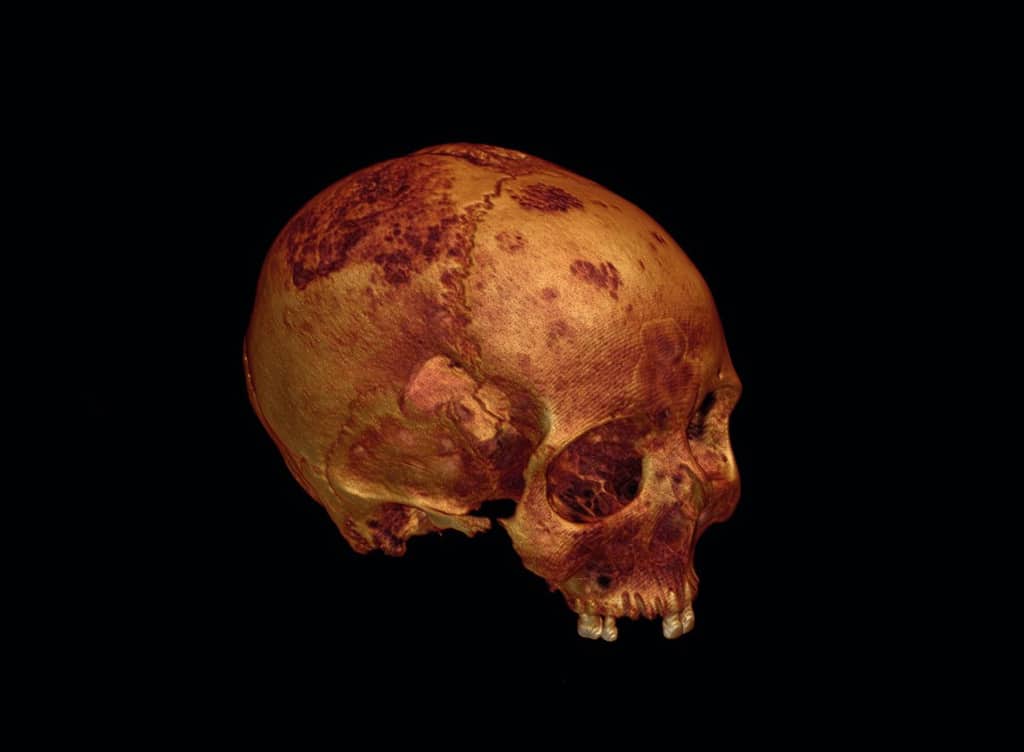 ¿Por qué este cráneo fue considerado sagrado hace 2.500 años?