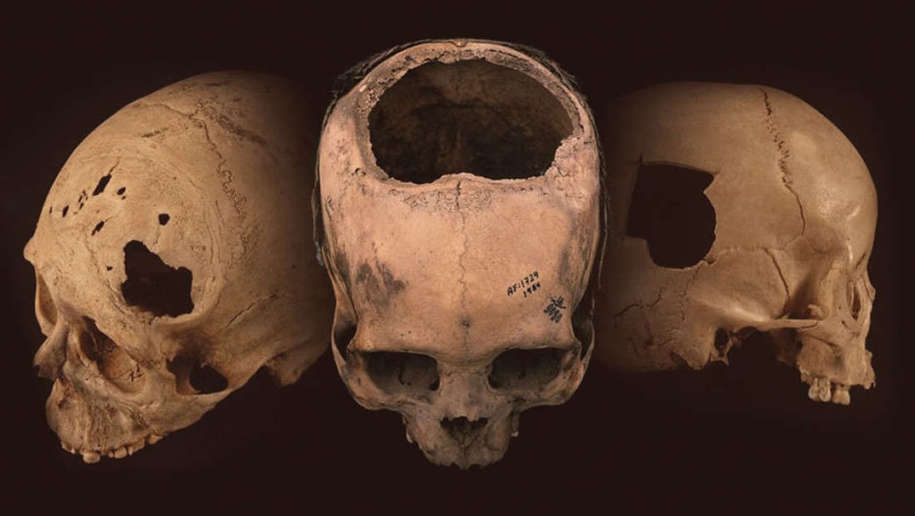 ¿Por qué estos cráneos incas sorprenden tanto a los científicos?