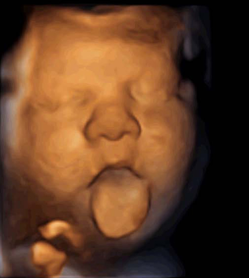 Los fetos sacan la lengua cuando escucha música: impresionantes imágenes