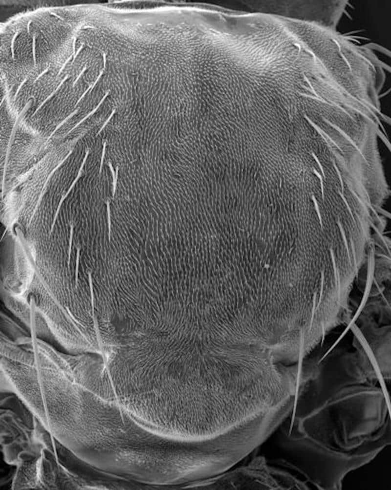 ¿Qué tiene que ver el pelo de las moscas con el cáncer?