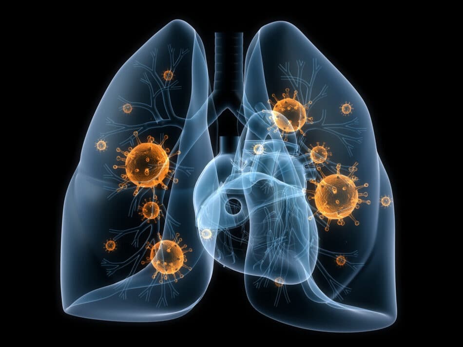 Tus pulmones son bombardeados constantemente por bacterias