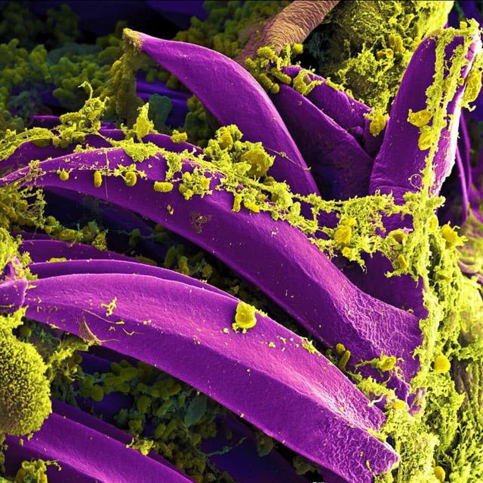 Un exceso de bacterias en el pene te hace más vulnerable al VIH